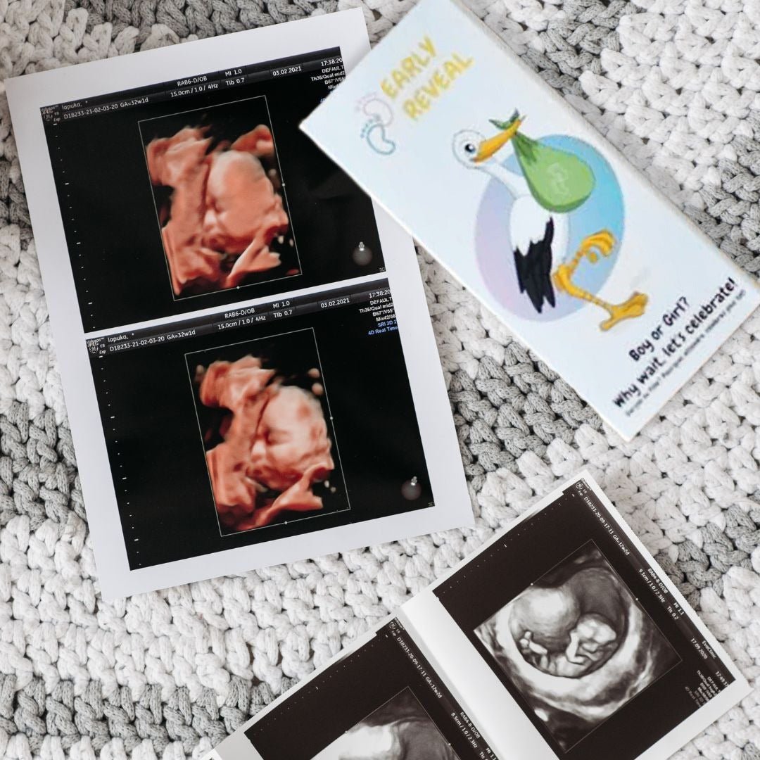 Discover Your Baby's Gender at Just 7 Weeks - EarlyReveal