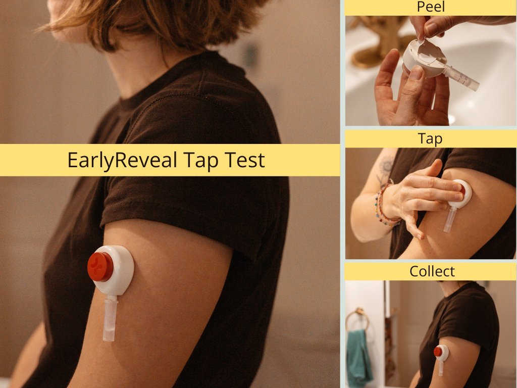 EarlyReveal Painless Express Tap Test | Over 99% Accurate | Needle Free Collection | Same Day Results - Early Reveal